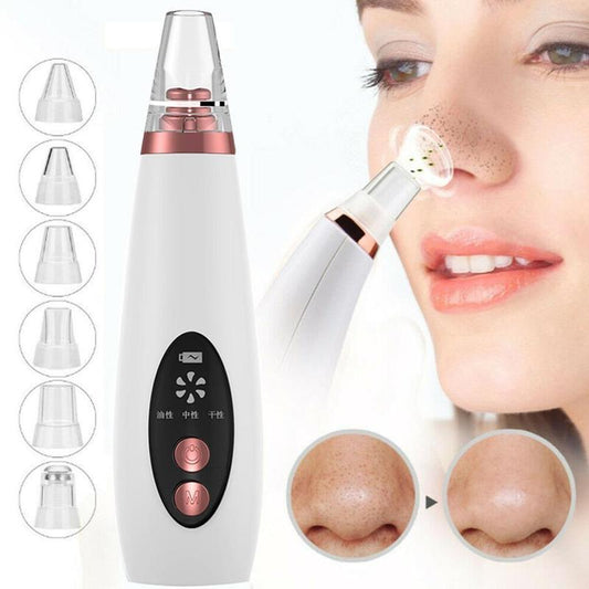 Acne/Pore Suction removal